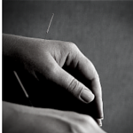 Dry Needling Acupuncture Glossop